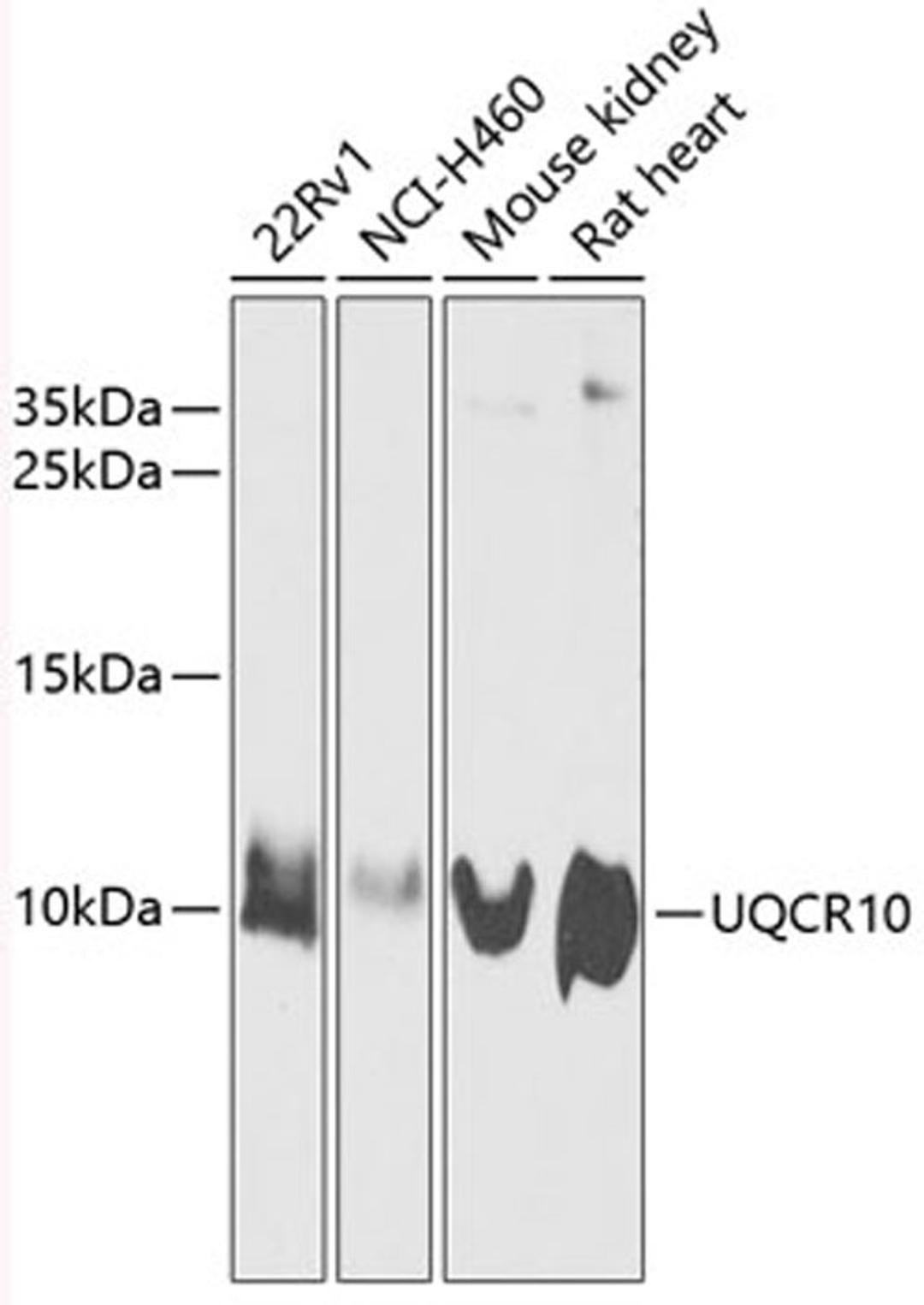 Western blot - UQCR10 antibody (A12587)