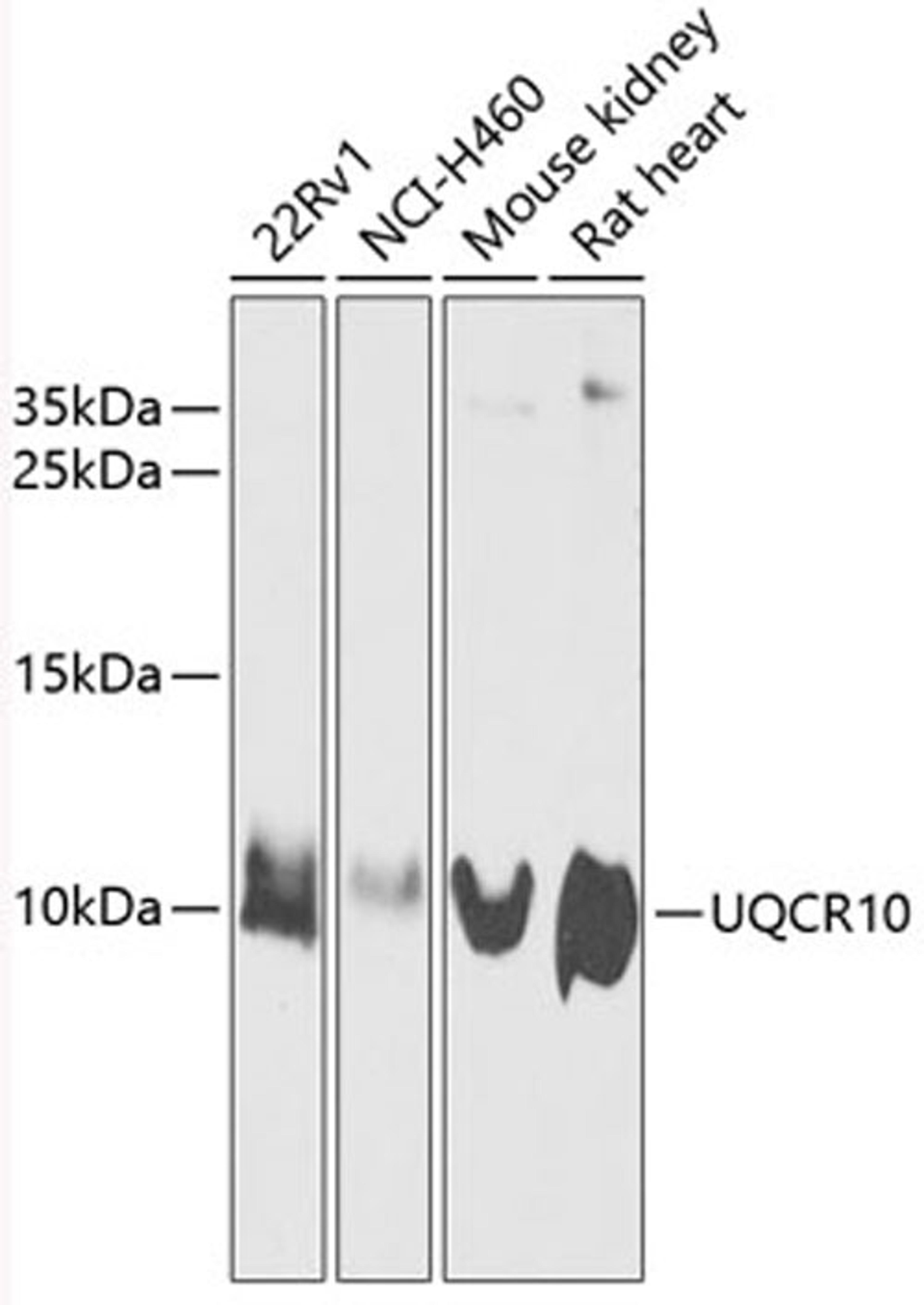 Western blot - UQCR10 antibody (A12587)