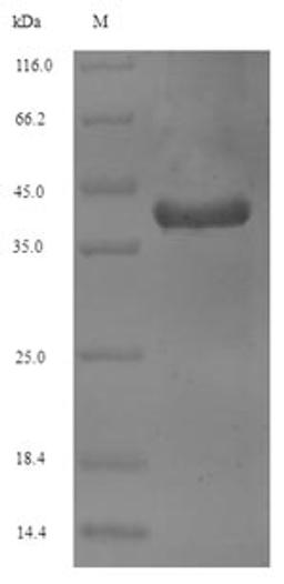 (Tris-Glycine gel) Discontinuous SDS-PAGE (reduced) with 5% enrichment gel and 15% separation gel.