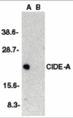 Western blot analysis of CIDE-A in human brain tissue lysate in the absence (A) or presence (B) of peptide (2085P) with CIDE-A antibody at 1:2000 dilution. 