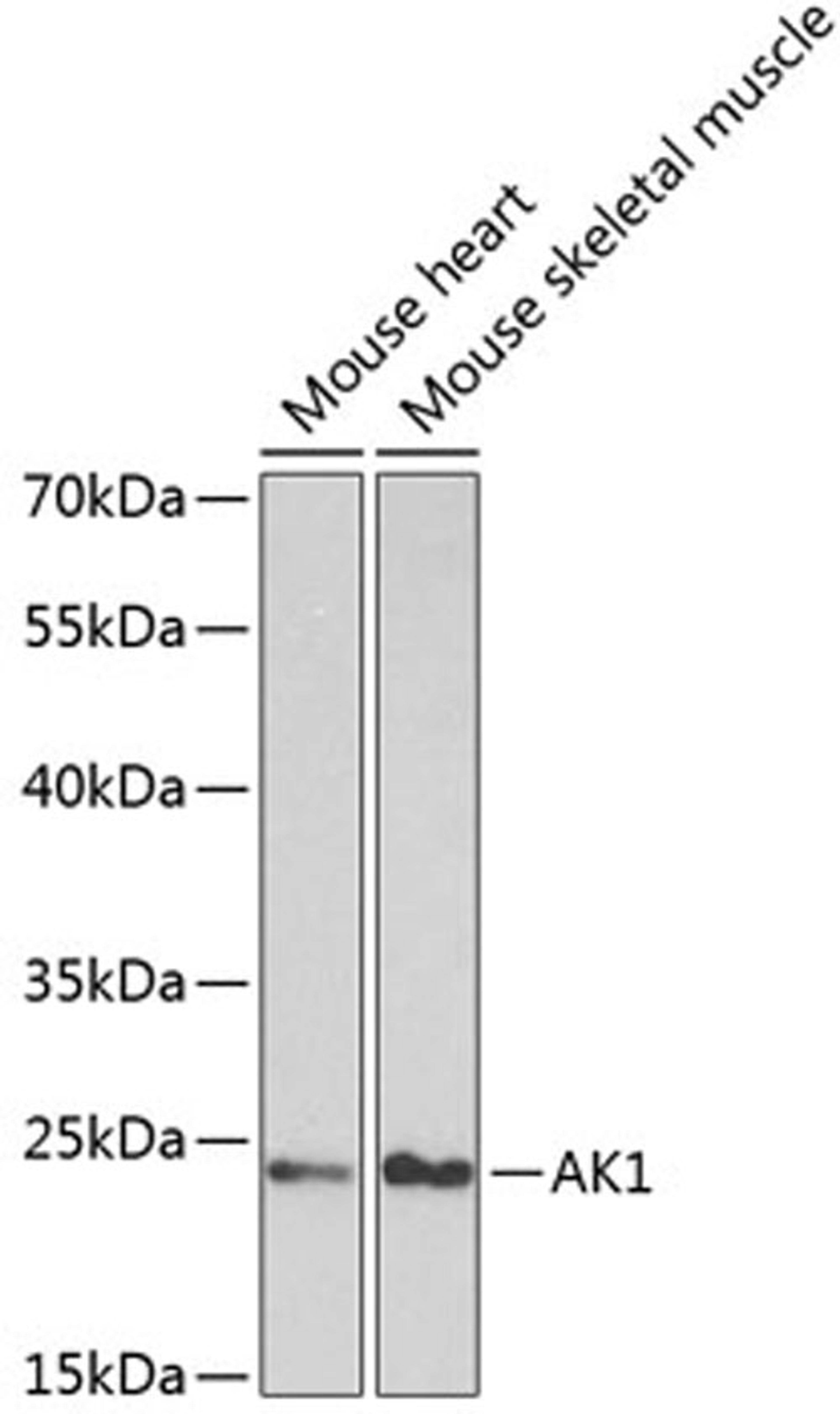 Western blot - AK1 antibody (A1218)