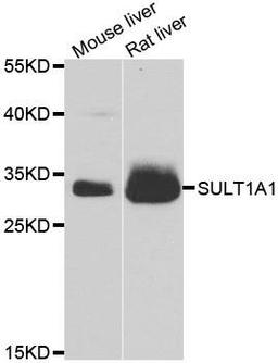 Western blot analysis of extracts of various cell lines using SULT1A1 antibody