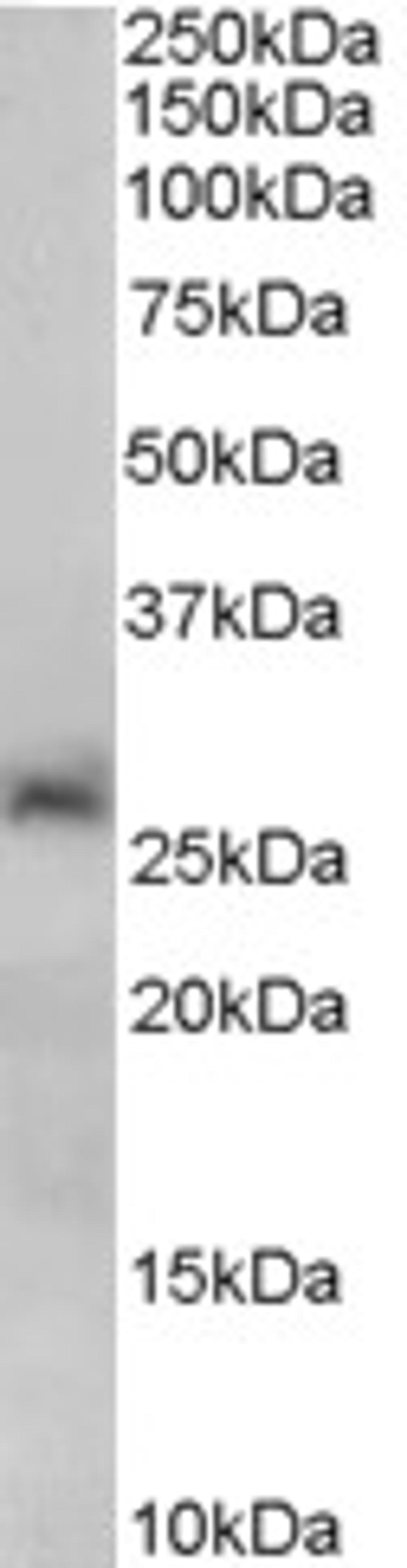 46-372 (0.2ug/ml) staining of Human Liver lysate (35ug protein in RIPA buffer). Primary incubation was 1 hour. Detected by chemiluminescence.