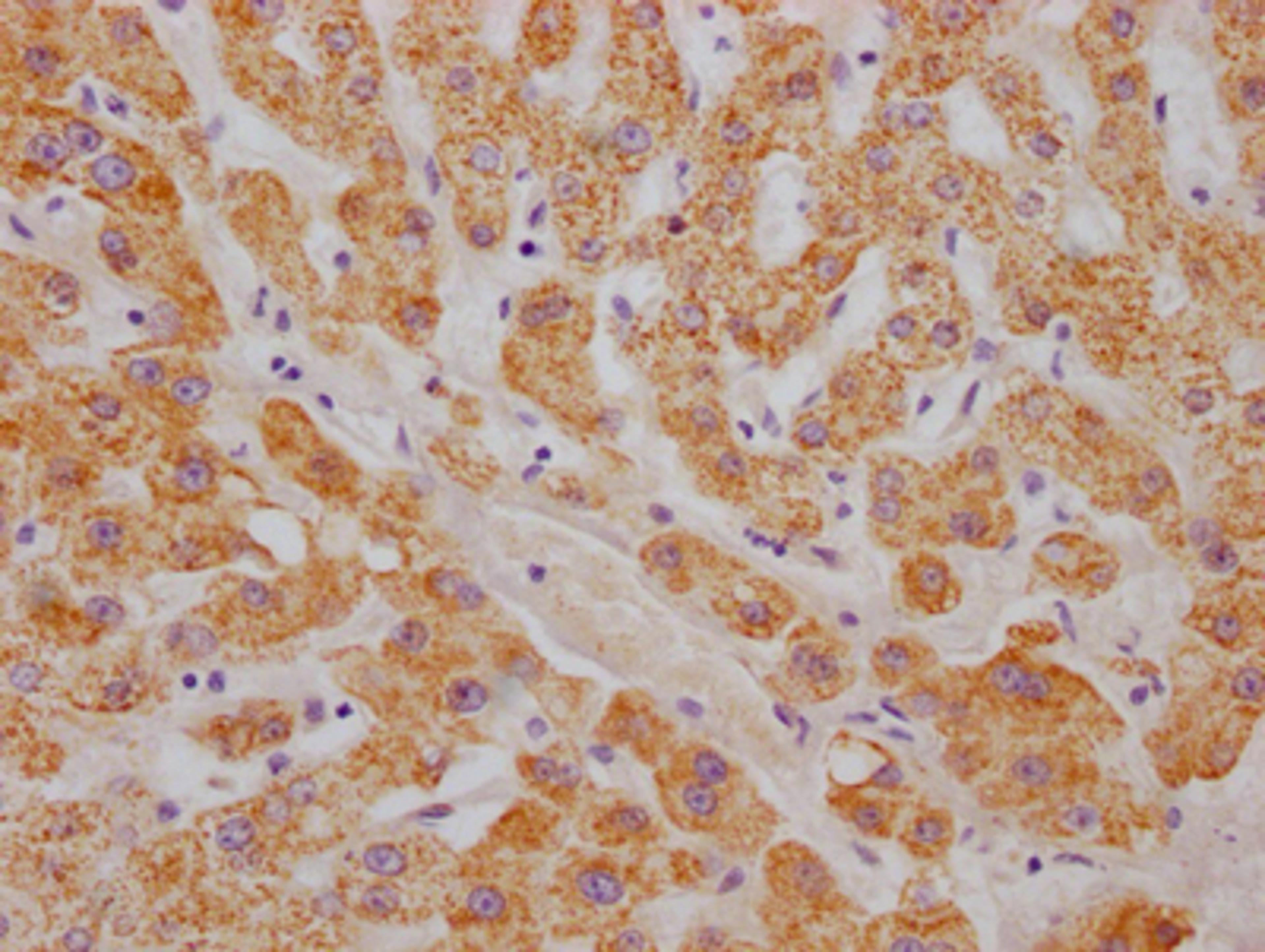 IHC image of CSB-RA242969A0HU diluted at 1:100 and staining in paraffin-embedded human liver tissue performed on a Leica BondTM system. After dewaxing and hydration, antigen retrieval was mediated by high pressure in a citrate buffer (pH 6.0). Section was blocked with 10% normal goat serum 30min at RT. Then primary antibody (1% BSA) was incubated at 4℃ overnight. The primary is detected by a Goat anti-rabbit IgG polymer labeled by HRP and visualized using 0.05% DAB.