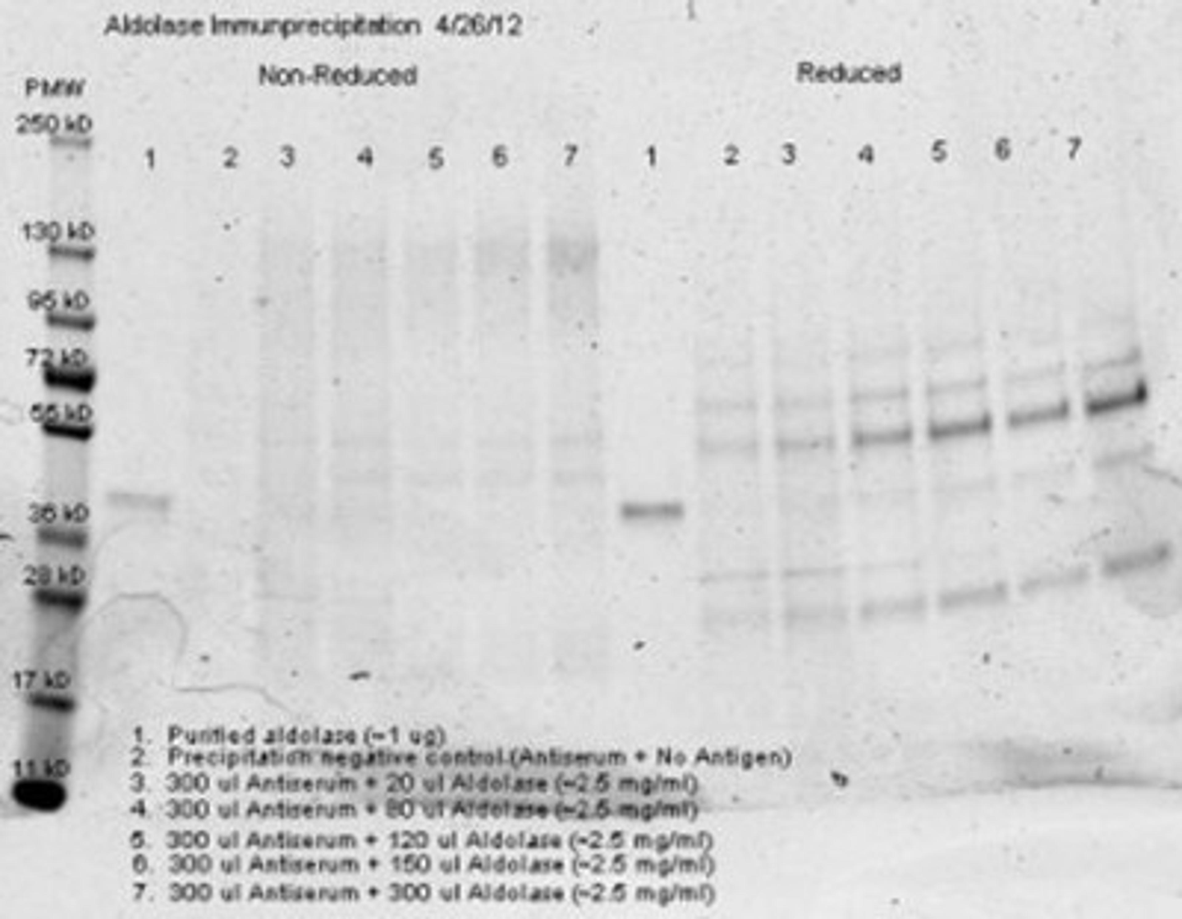 Immunoprecipitation: Aldolase A Antibody [NB600-915] - Analysis using the Biotin conjugate of NB600-915. Detection of 300 ul of anti aldolase antiserum and an equal volume of varied amounts (diluted from a stock solution of ~2.5 ug/ml) of purified aldolase in PBS. Precipitation of aldolase was confirmed.