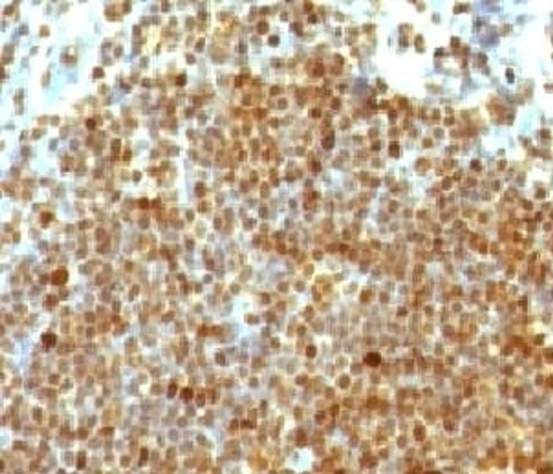 Formalin-fixed, paraffin-embedded human tonsil stained with PCNA antibody (PM441-1)