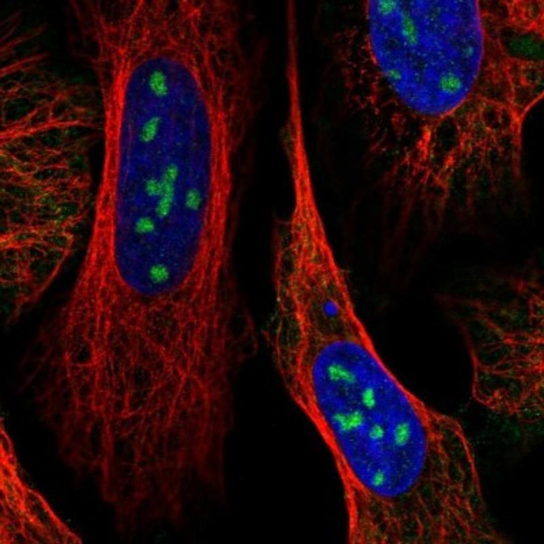 Immunocytochemistry/Immunofluorescence: ARNTL2 Antibody [NBP2-32423] - Immunofluorescent staining of human cell line U-2 OS shows positivity in nucleoli.