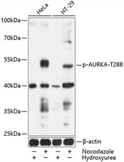 Western blot - Phospho-AURKA-T288 antibody (AP0523)