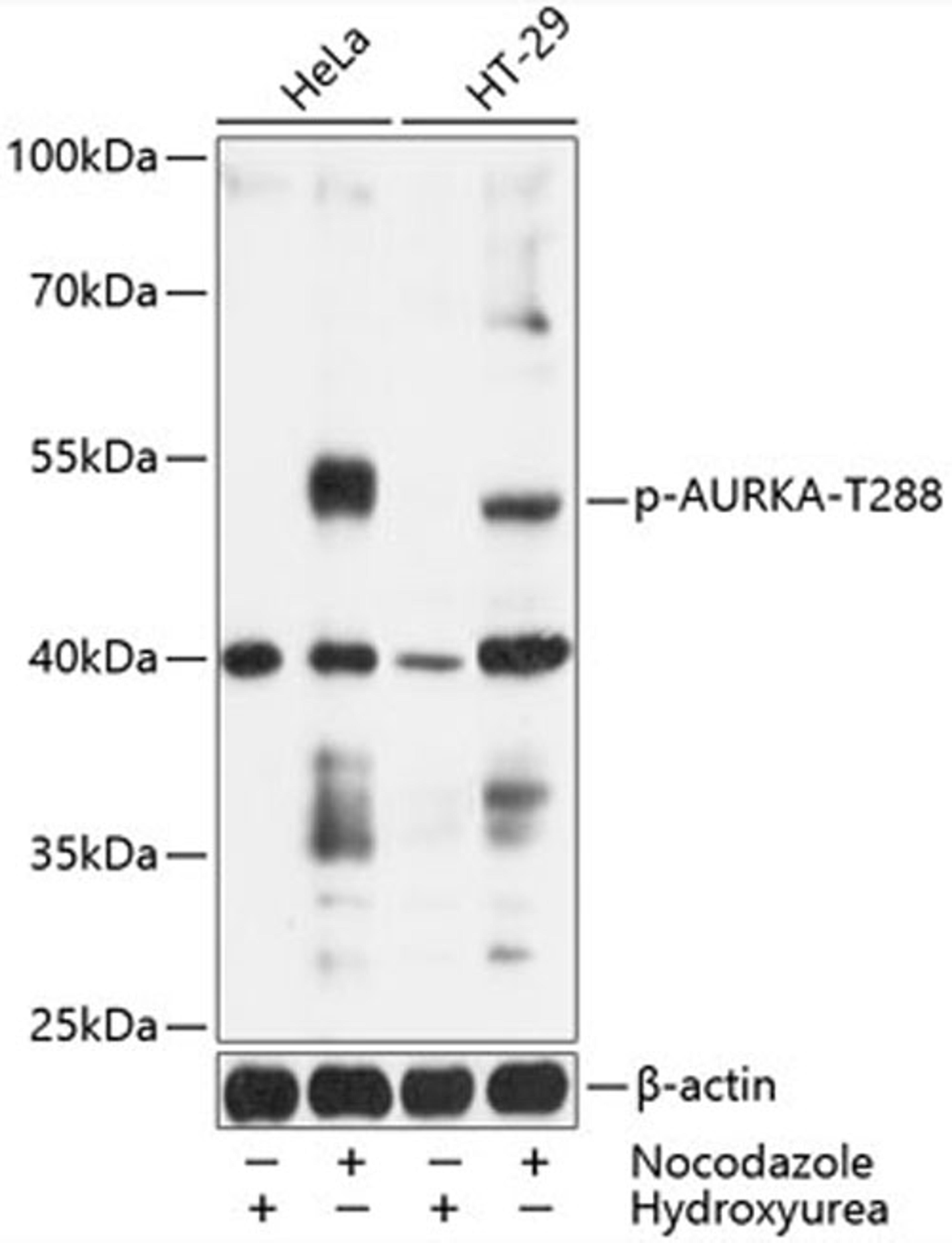 Western blot - Phospho-AURKA-T288 antibody (AP0523)