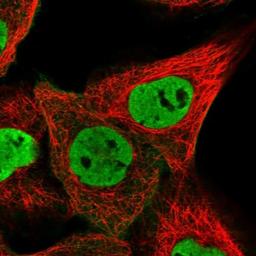 Immunocytochemistry/Immunofluorescence: ZNF655 Antibody [NBP1-80625] - Immunofluorescent staining of human cell line A-431 shows positivity in nucleus but not nucleoli & plasma membrane.