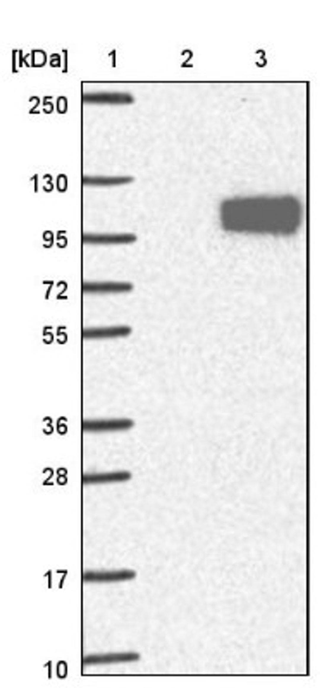 Western Blot: PCSK7 Antibody [NBP1-81292] - Lane 1: Marker [kDa] 250, 130, 95, 72, 55, 36, 28, 17, 10<br/>Lane 2: Negative control (vector only transfected HEK293T lysate)<br/>Lane 3: Over-expression lysate (Co-expressed with a C-terminal myc-DDK tag (~3.1 kDa) in mammalian HEK293T cells, LY401489)