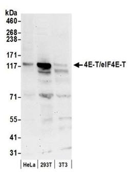 Detection of human and mouse 4E-T/eIF4E-T by western blot.