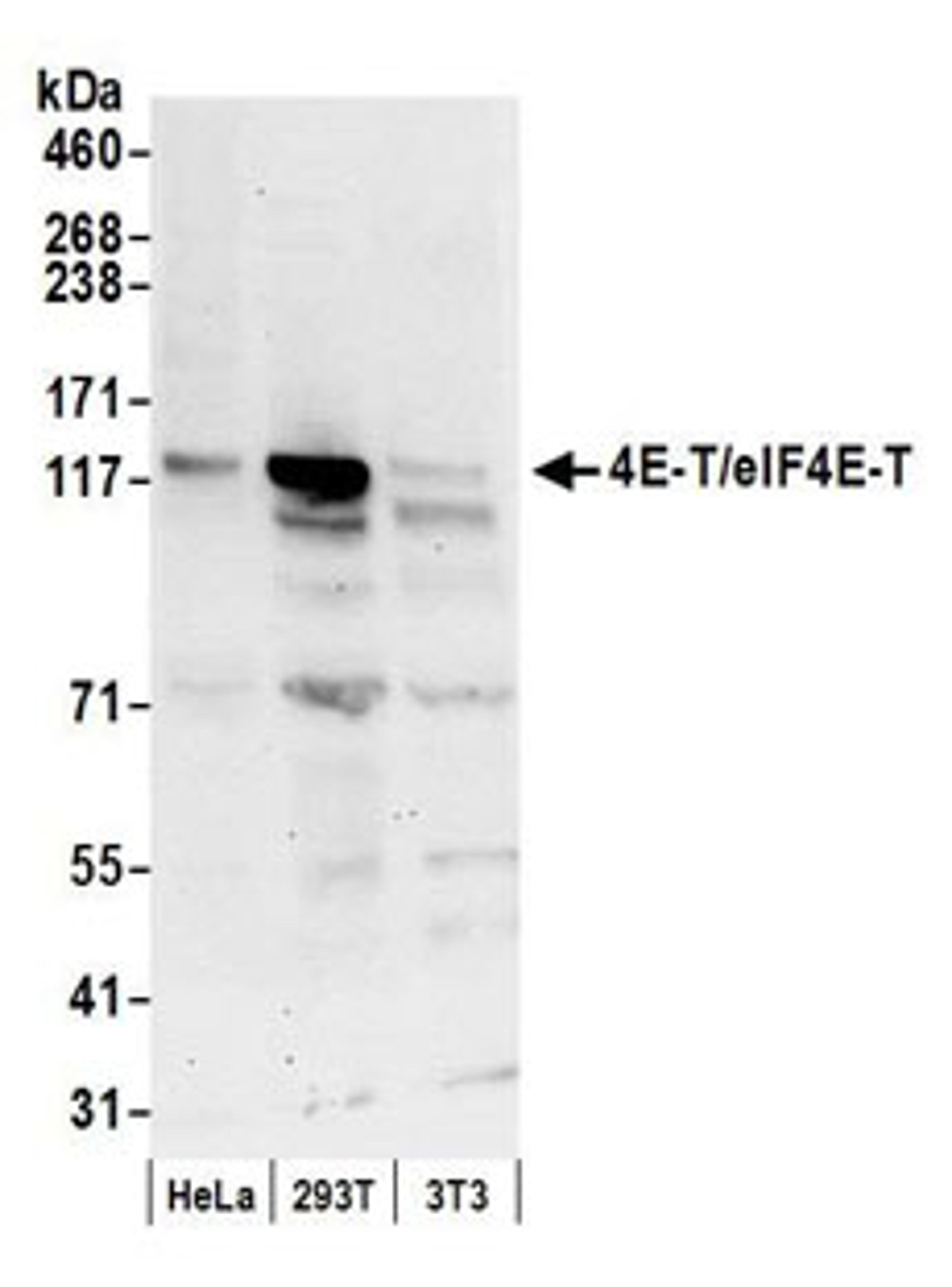 Detection of human and mouse 4E-T/eIF4E-T by western blot.