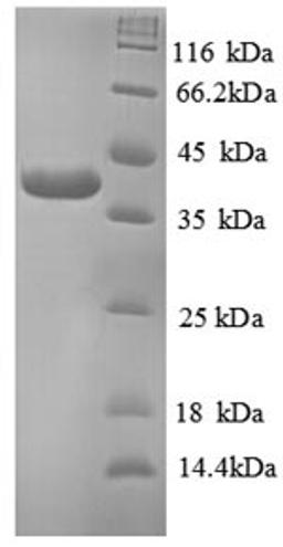 (Tris-Glycine gel) Discontinuous SDS-PAGE (reduced) with 5% enrichment gel and 15% separation gel.