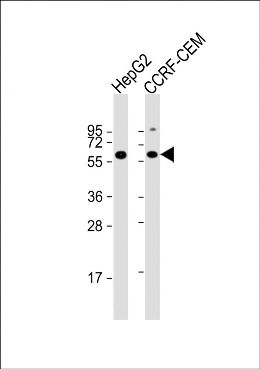 Western Blot at 1:2000 dilution Lane 1: HepG2 whole cell lysate Lane 2: CCRF-CEM whole cell lysate Lysates/proteins at 20 ug per lane.