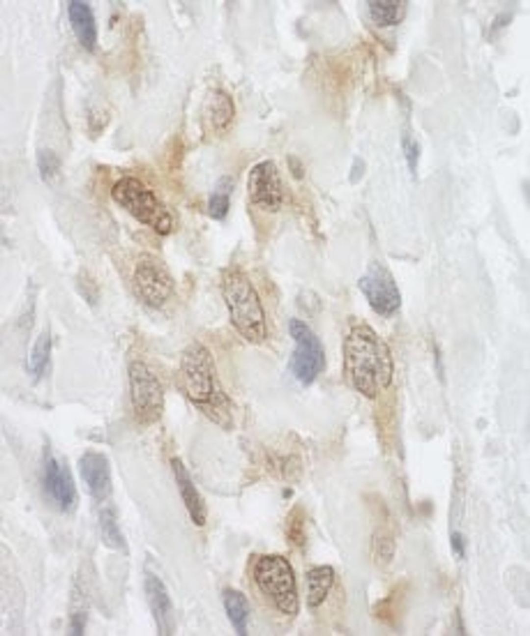 Detection of human LPP by immunohistochemistry.