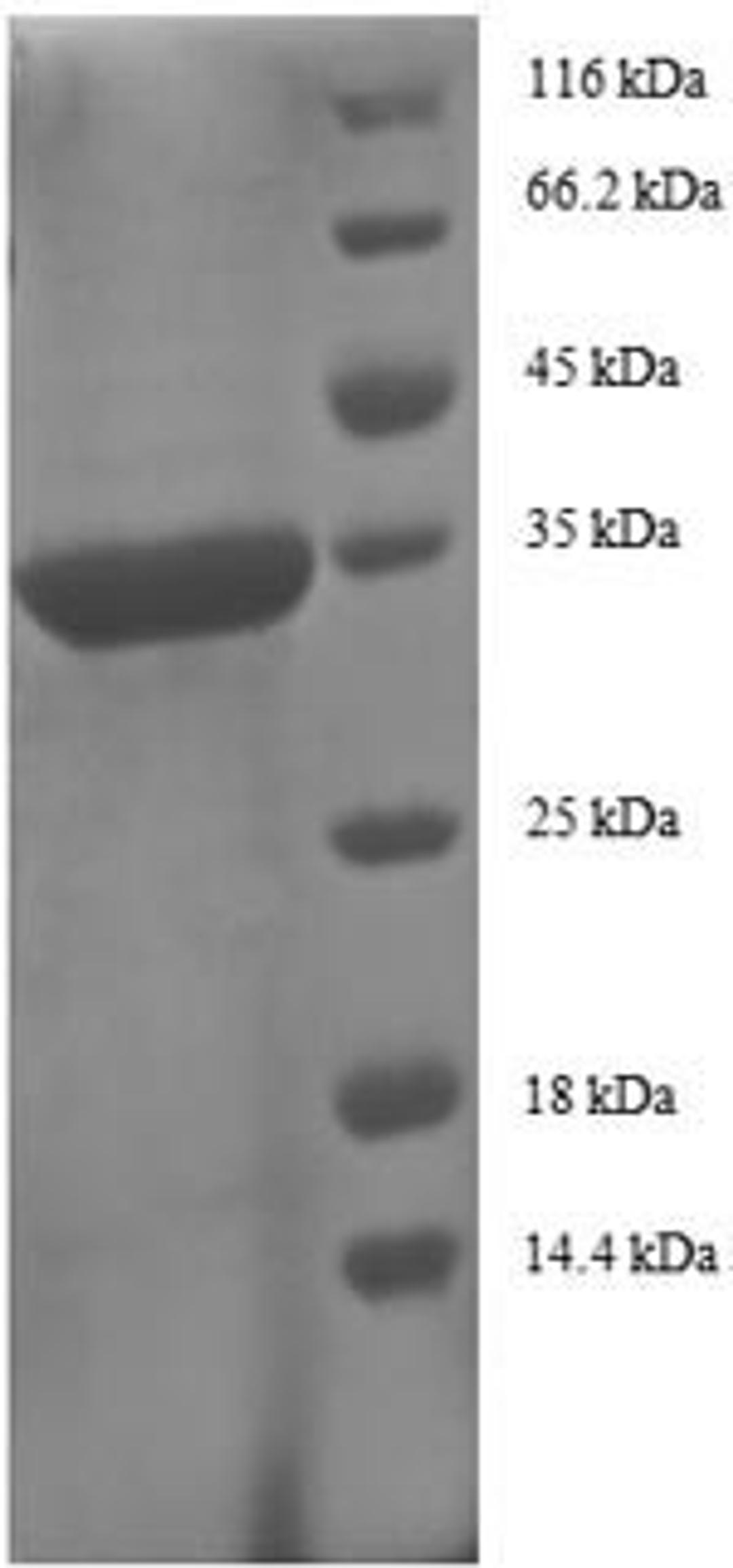 (Tris-Glycine gel) Discontinuous SDS-PAGE (reduced) with 5% enrichment gel and 15% separation gel.