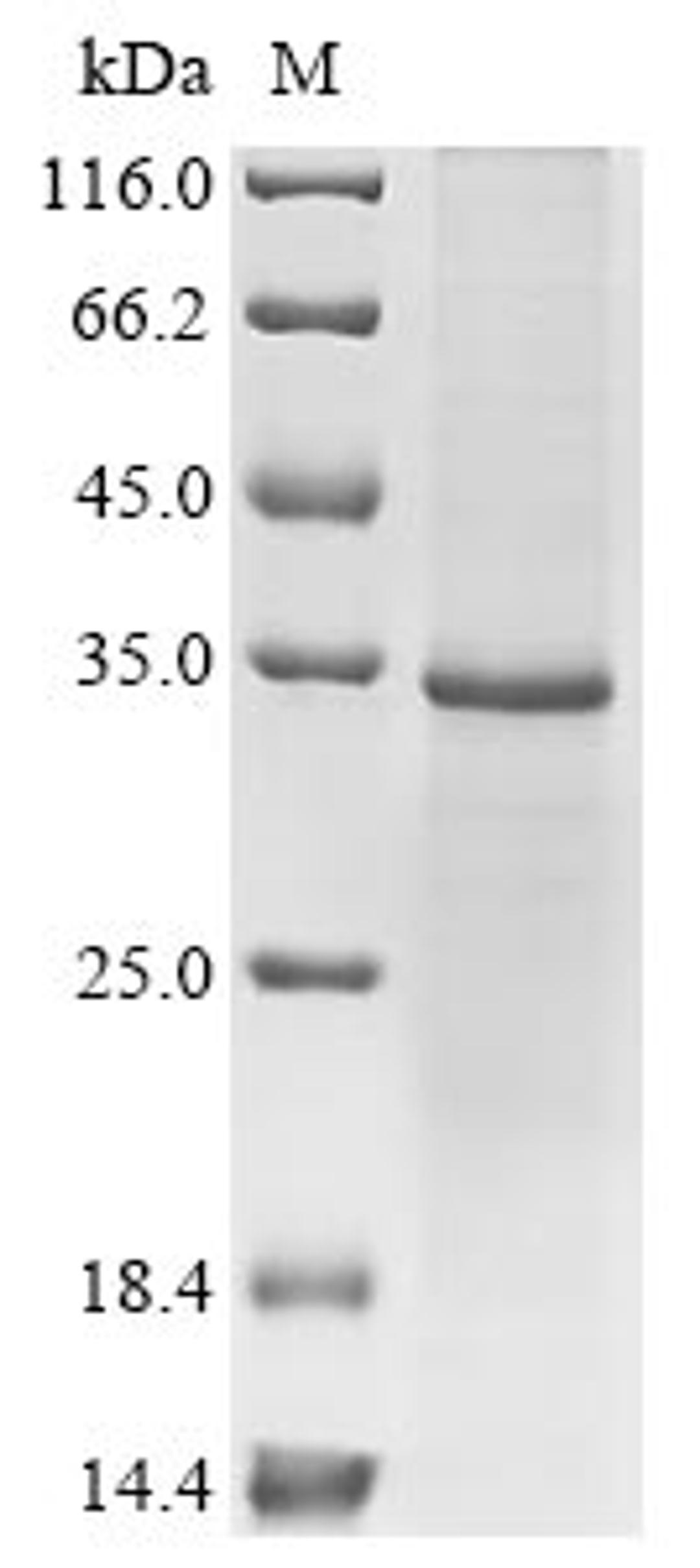 (Tris-Glycine gel) Discontinuous SDS-PAGE (reduced) with 5% enrichment gel and 15% separation gel.