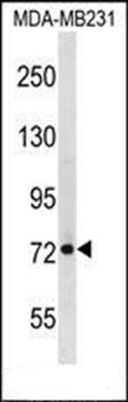 Western blot analysis of MDA-MB231 cell line lysates (35ug/lane) using RMI1 antibody (N-term)