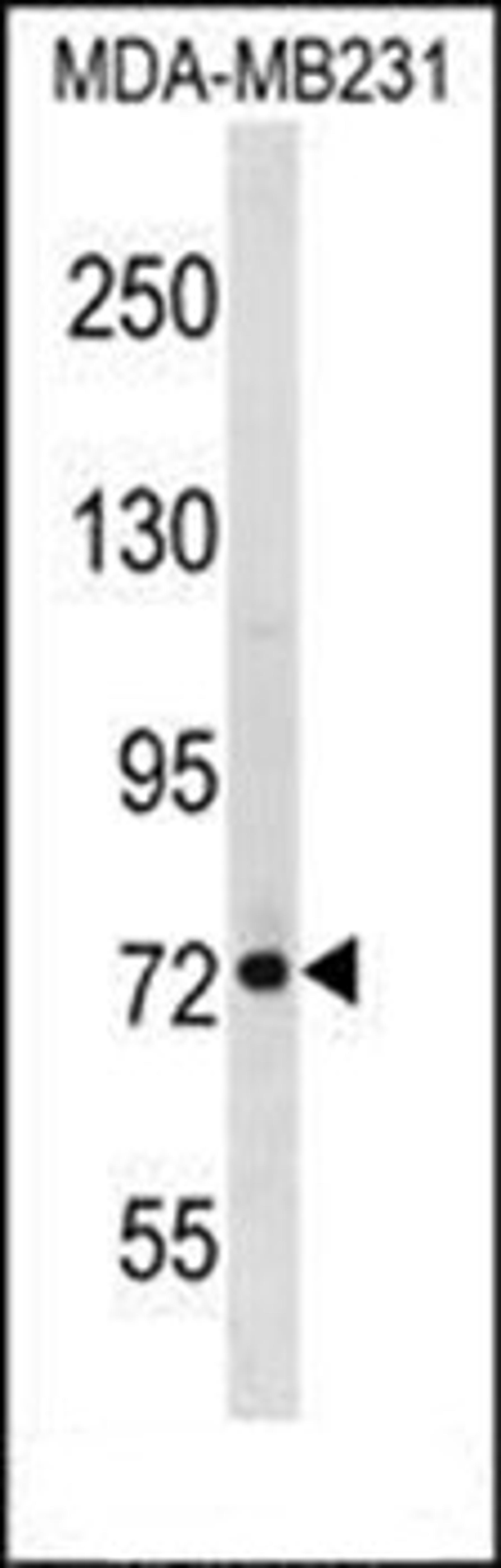 Western blot analysis of MDA-MB231 cell line lysates (35ug/lane) using RMI1 antibody (N-term)