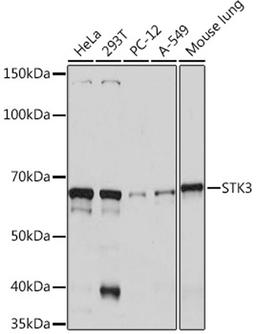 Western blot - STK3 Rabbit mAb (A9036)