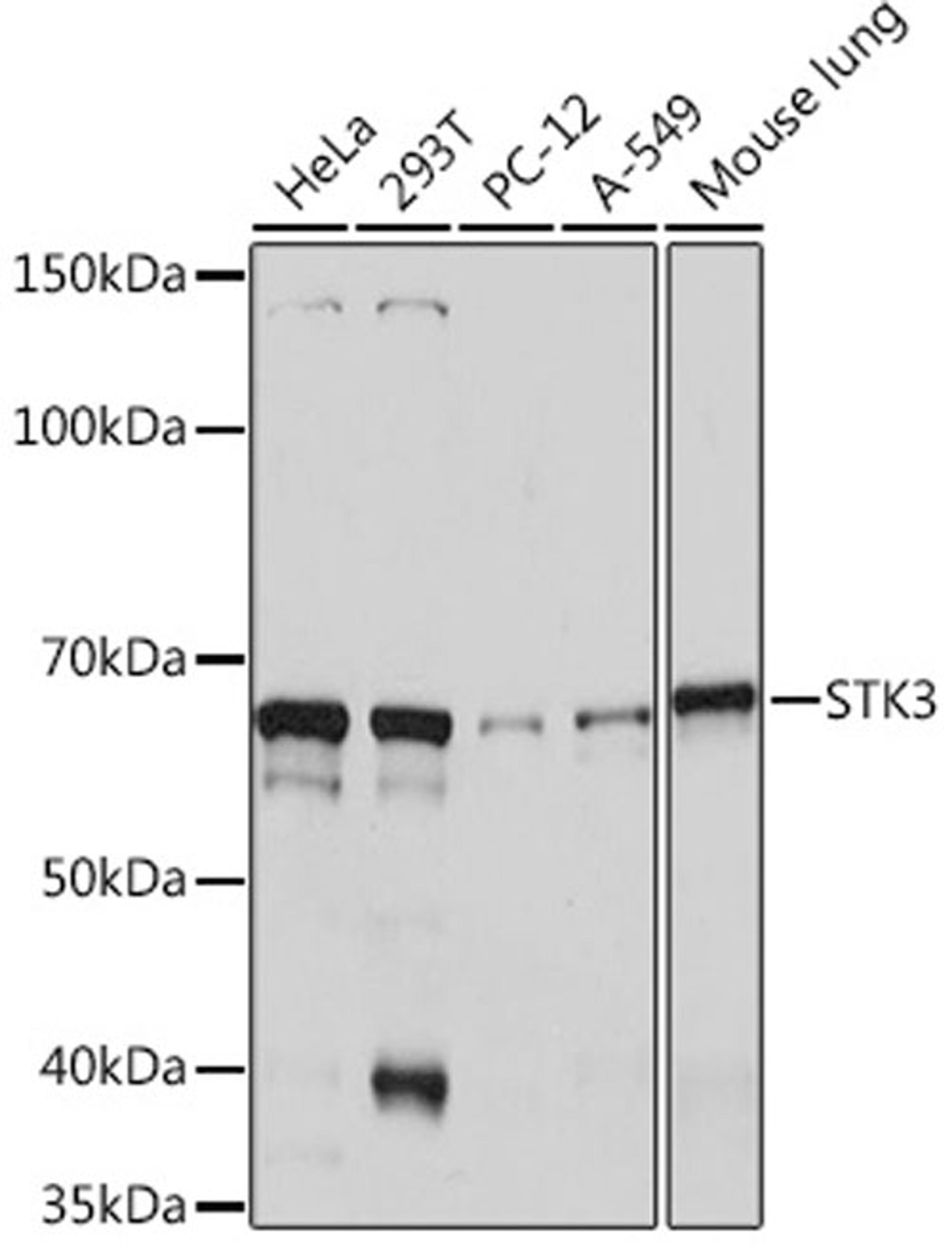 Western blot - STK3 Rabbit mAb (A9036)