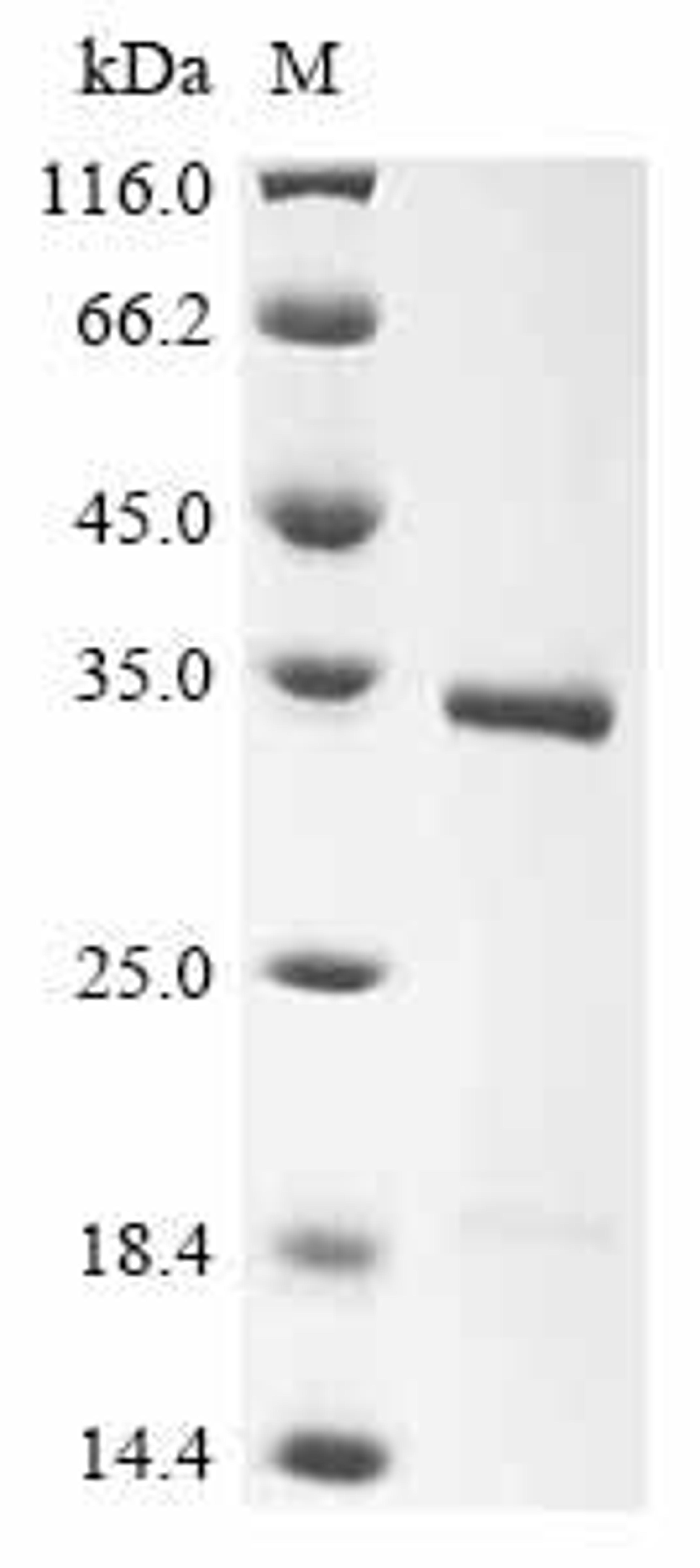 (Tris-Glycine gel) Discontinuous SDS-PAGE (reduced) with 5% enrichment gel and 15% separation gel.