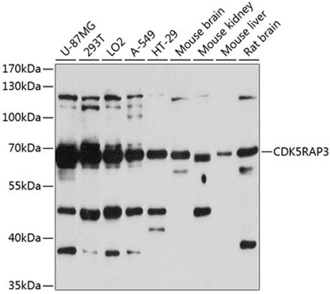 Western blot - CDK5RAP3 antibody (A5000)