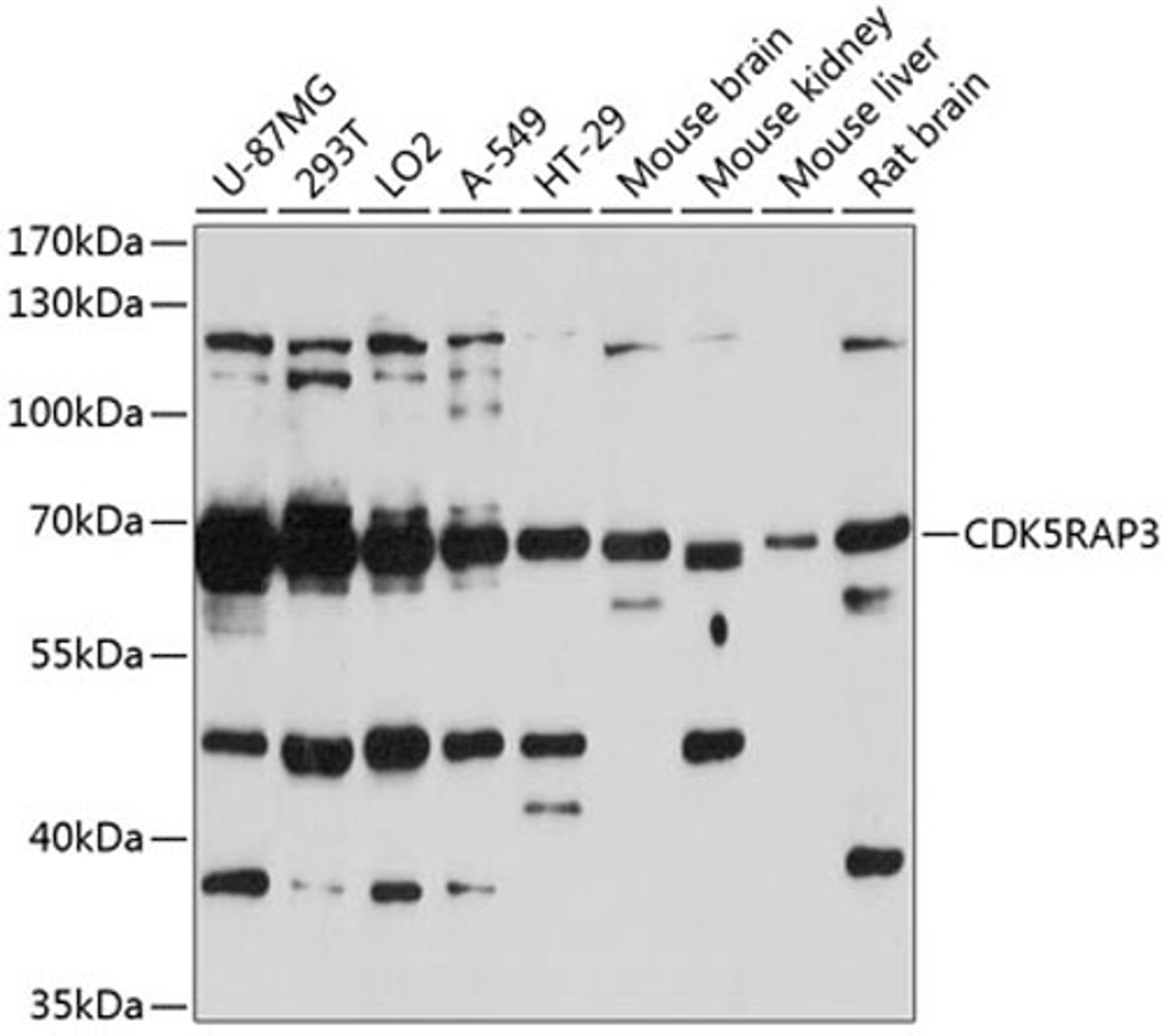 Western blot - CDK5RAP3 antibody (A5000)