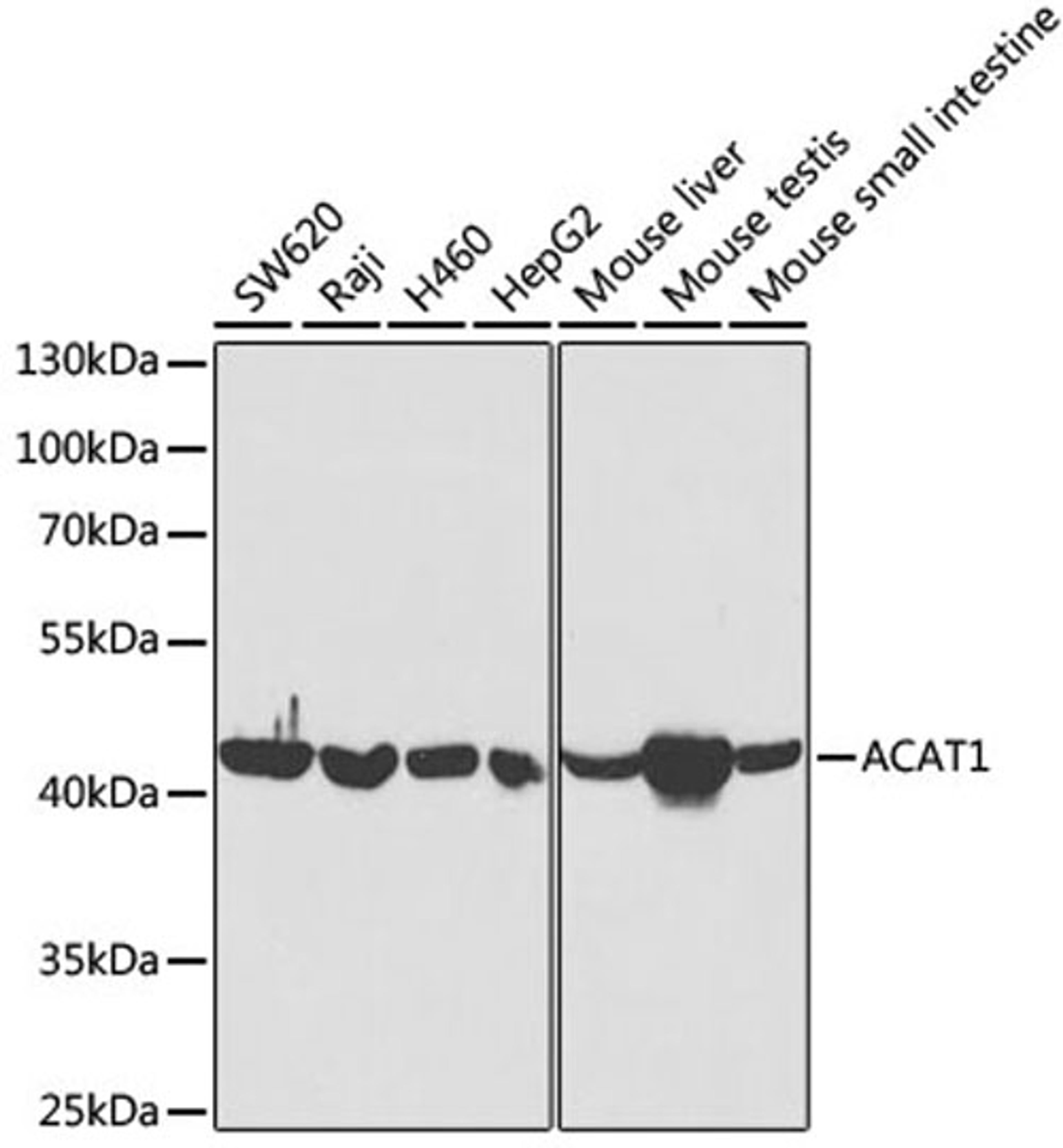 Western blot - ACAT1 antibody (A13273)