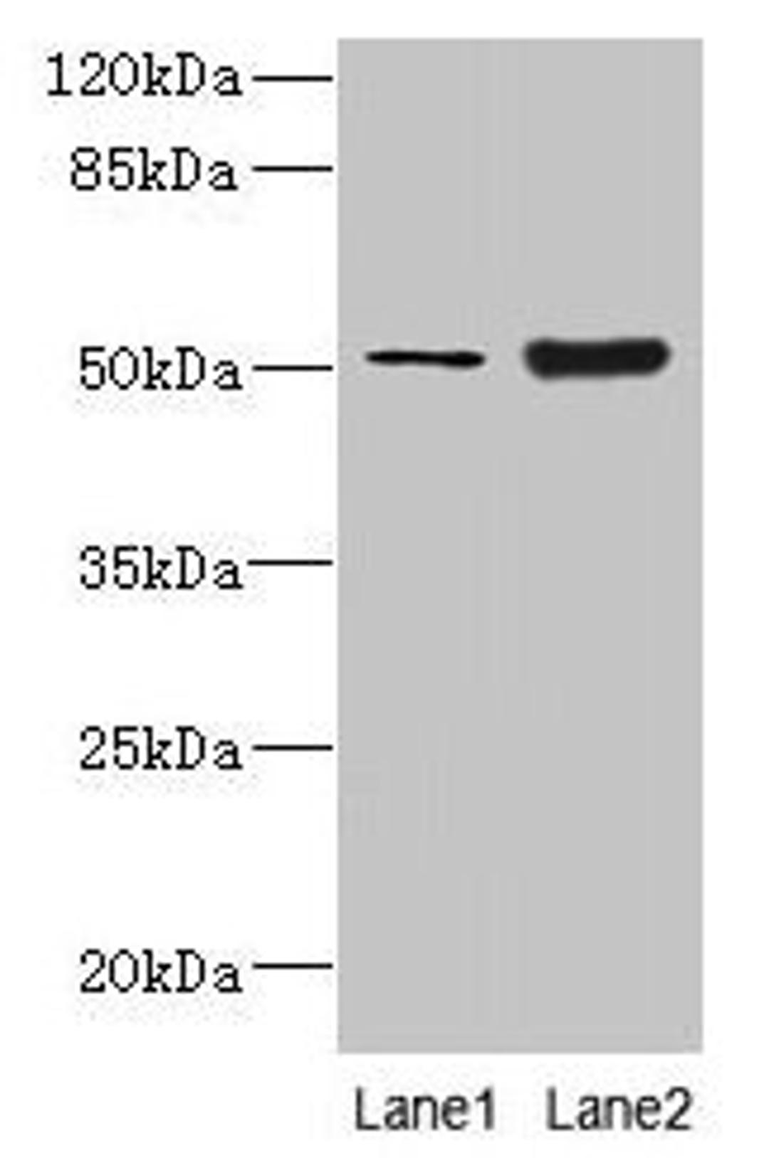 Western blot. All lanes: KRT80 antibody at 2µg/ml. Lane 1: A549 whole cell lysate. Lane 2: Mouse brain tissue. Secondary. Goat polyclonal to rabbit IgG at 1/10000 dilution. Predicted band size: 51, 48, 55 kDa. Observed band size: 51 kDa