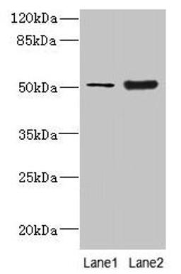 Western blot. All lanes: KRT80 antibody at 2µg/ml. Lane 1: A549 whole cell lysate. Lane 2: Mouse brain tissue. Secondary. Goat polyclonal to rabbit IgG at 1/10000 dilution. Predicted band size: 51, 48, 55 kDa. Observed band size: 51 kDa