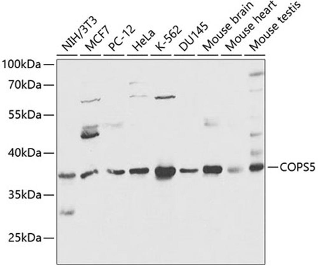 Western blot - COPS5 antibody (A13401)