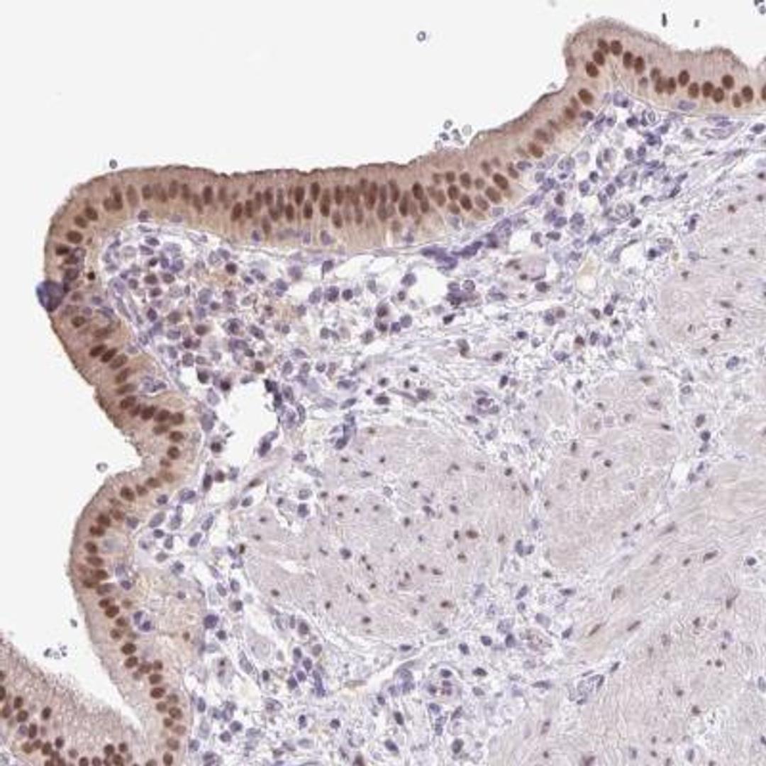 Immunohistochemistry: ONECUT2/OC-2 Antibody [NBP2-31658] - Staining of human gallbladder shows strong nuclear positivity in glandular cells.