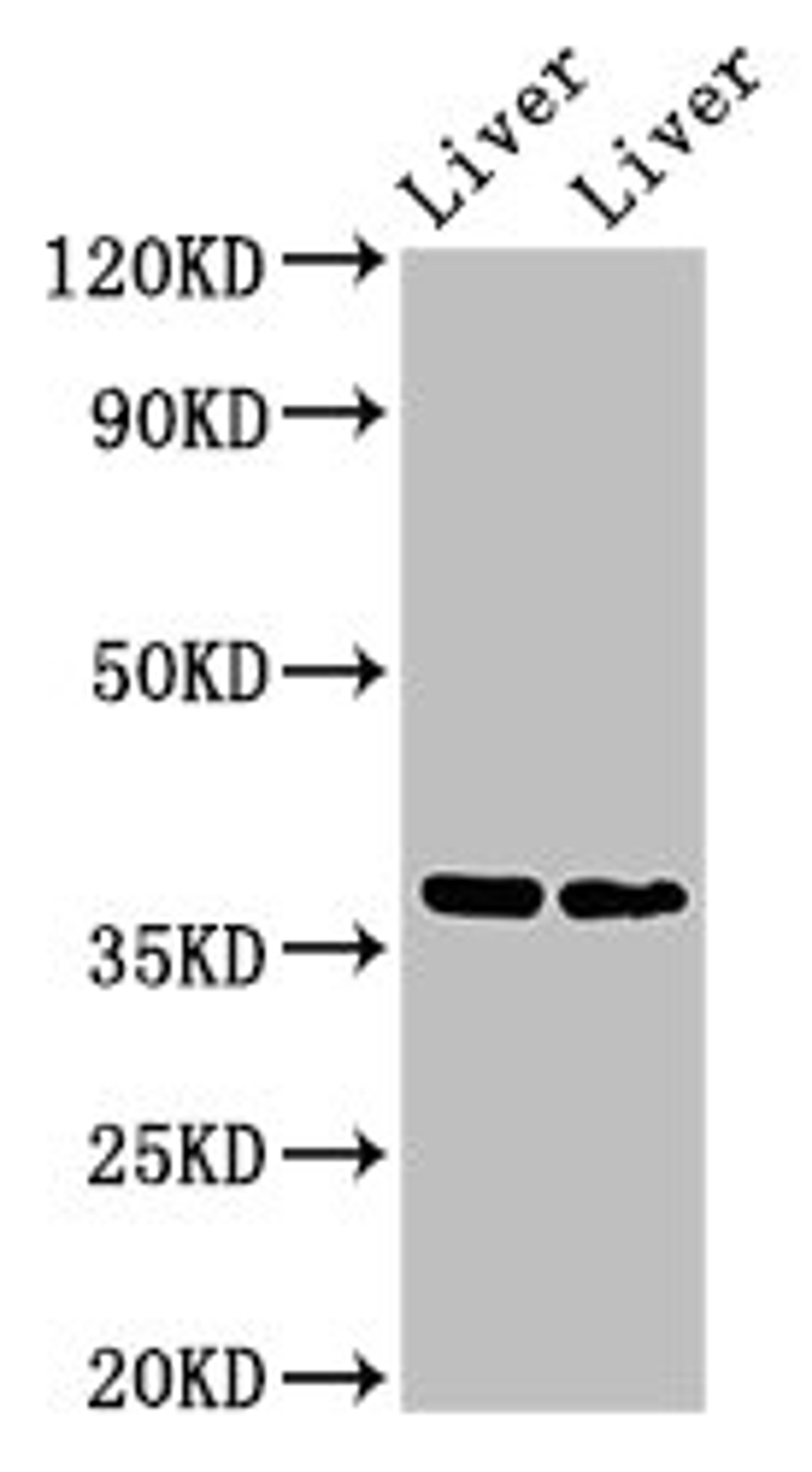 Western Blot. Positive WB detected in: Mouse liver tissue, Rat liver tissue. All lanes: CCNH antibody at 3ug/ml. Secondary. Goat polyclonal to rabbit IgG at 1/50000 dilution. Predicted band size: 38 kDa. Observed band size: 38 kDa. 
