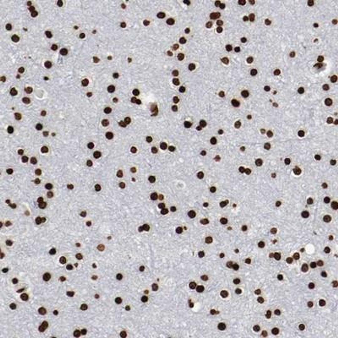 Immunohistochemistry: BARHL1 Antibody [NBP1-86513] - Immunohistochemical staining of human cerebral cortex shows strong nuclear positivity in neuronal cells and glial cells.