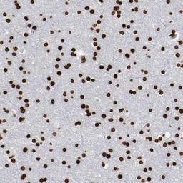 Immunohistochemistry: BARHL1 Antibody [NBP1-86513] - Immunohistochemical staining of human cerebral cortex shows strong nuclear positivity in neuronal cells and glial cells.