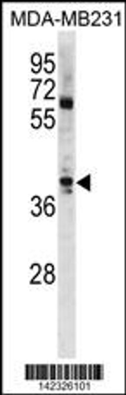 Western blot analysis in MDA-MB231 cell line lysates (35ug/lane).