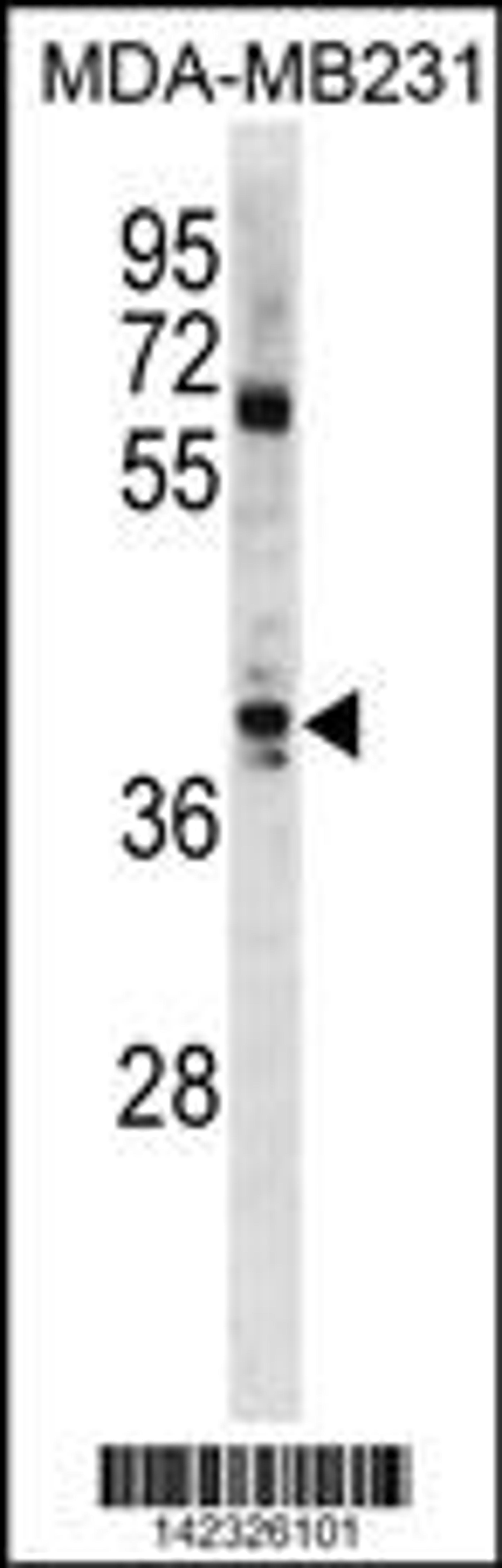 Western blot analysis in MDA-MB231 cell line lysates (35ug/lane).