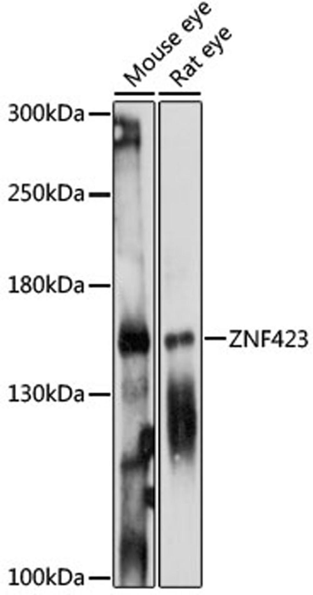 Western blot - ZNF423 antibody (A15795)