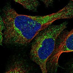 Immunocytochemistry/Immunofluorescence: RAB11FIP3 Antibody [NBP1-83998] Staining of human cell line U-2 OS shows positivity in vesicles & centrosome.