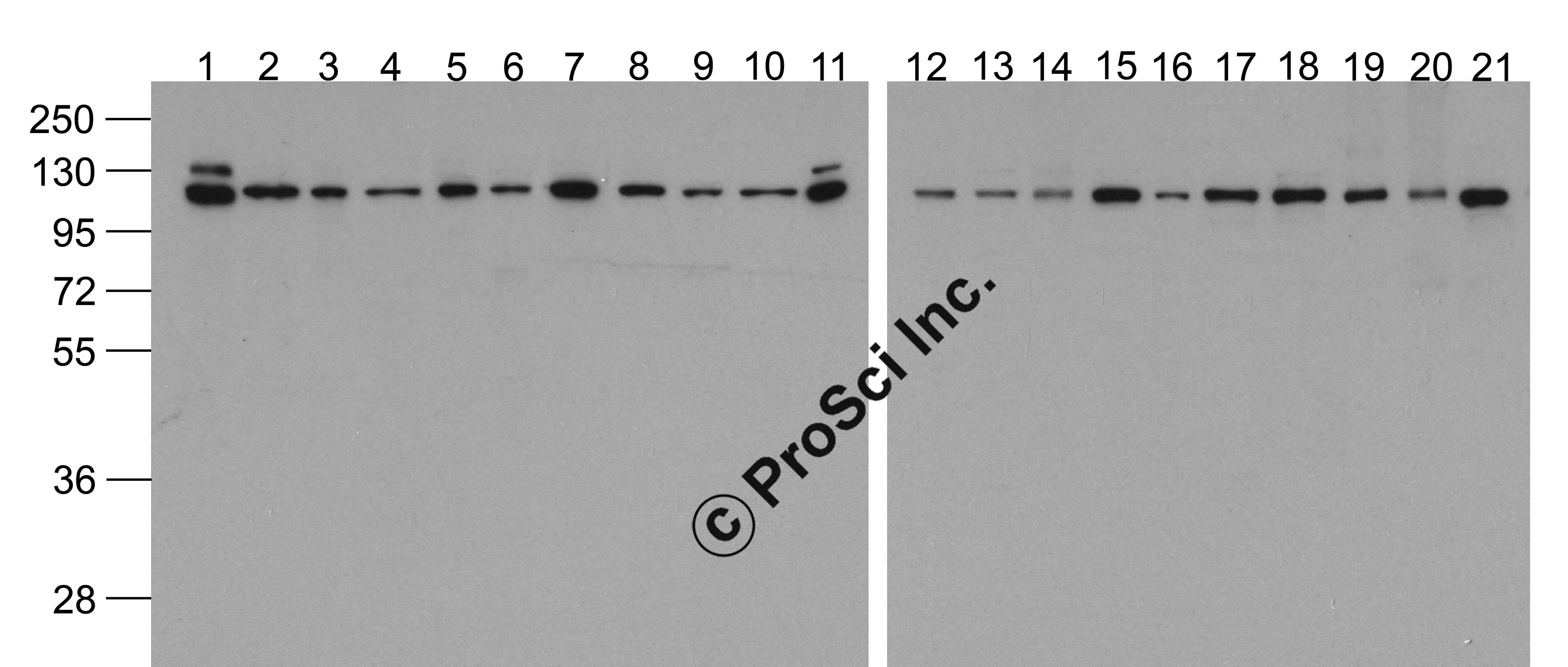 Western blot analysis of Vinculin in 293, A431, A549, Daudi, HeLa, HepG2, K562, 3T3, Raji, U937 cell lysate and mouse brain, rat brain, rabbit brain, mouse lung, rat lung, mouse liver, rat liver, rabbit spleen, chicken liver and chicken small intestine ti