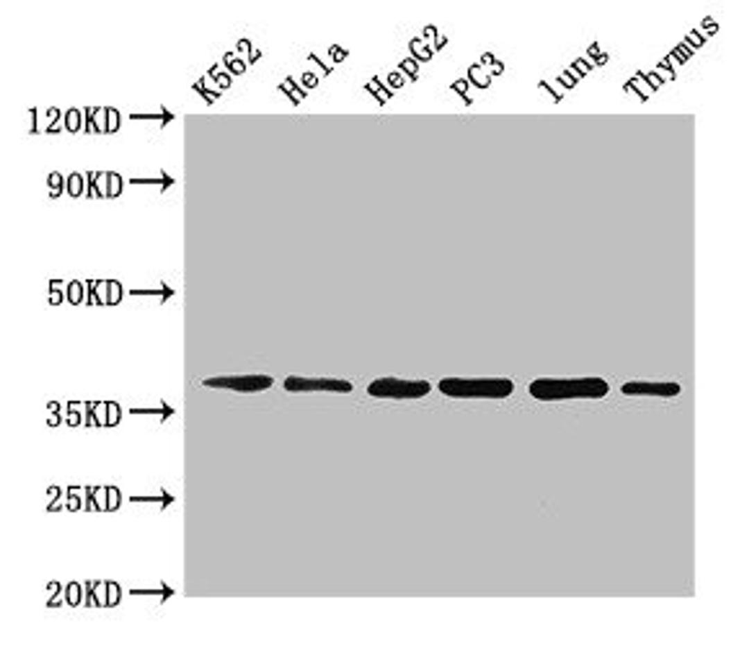 Western Blot. Positive WB detected in: K562 whole cell lysate, Hela whole cell lysate, HepG2 whole cell lysate, PC-3 whole cell lysate, Mouse lung tissue, Mouse thymus tissue. All lanes: Anxa1 antibody at 5µg/ml. Secondary. Goat polyclonal to rabbit IgG at 1/50000 dilution. predicted band size: 39 kDa. observed band size: 39 kDa