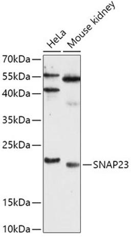 Western blot - SNAP23 antibody (A13909)