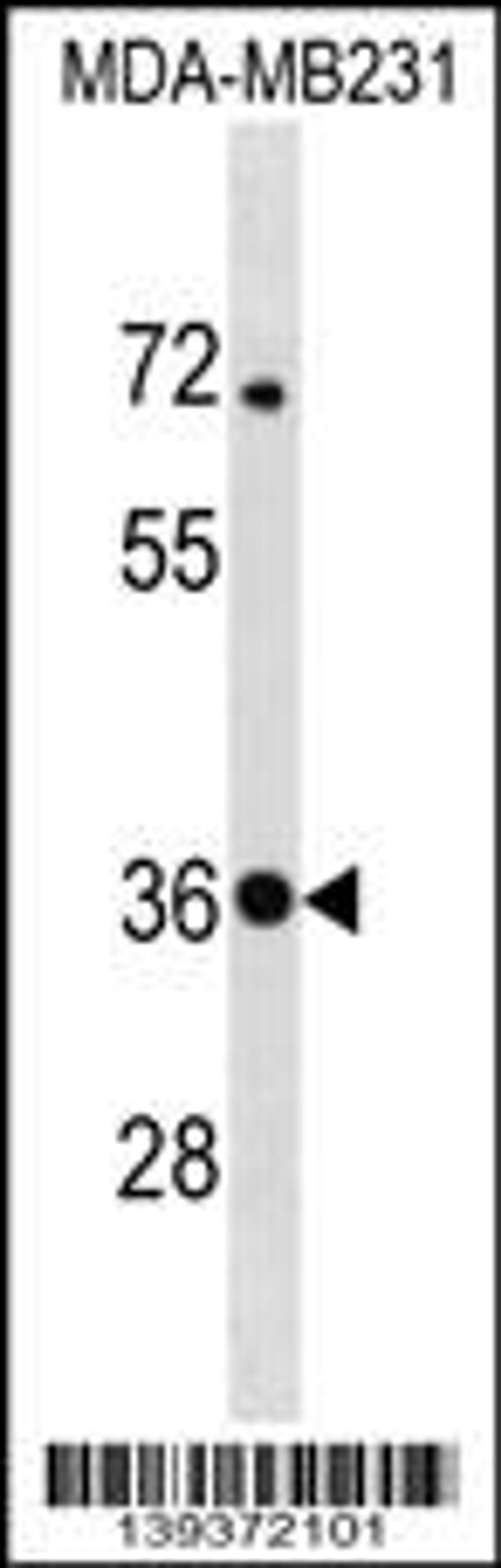 Western blot analysis in MDA-MB231 cell line lysates (35ug/lane).