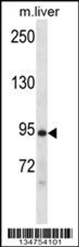 Western blot analysis in mouse liver tissue lysates (35ug/lane).