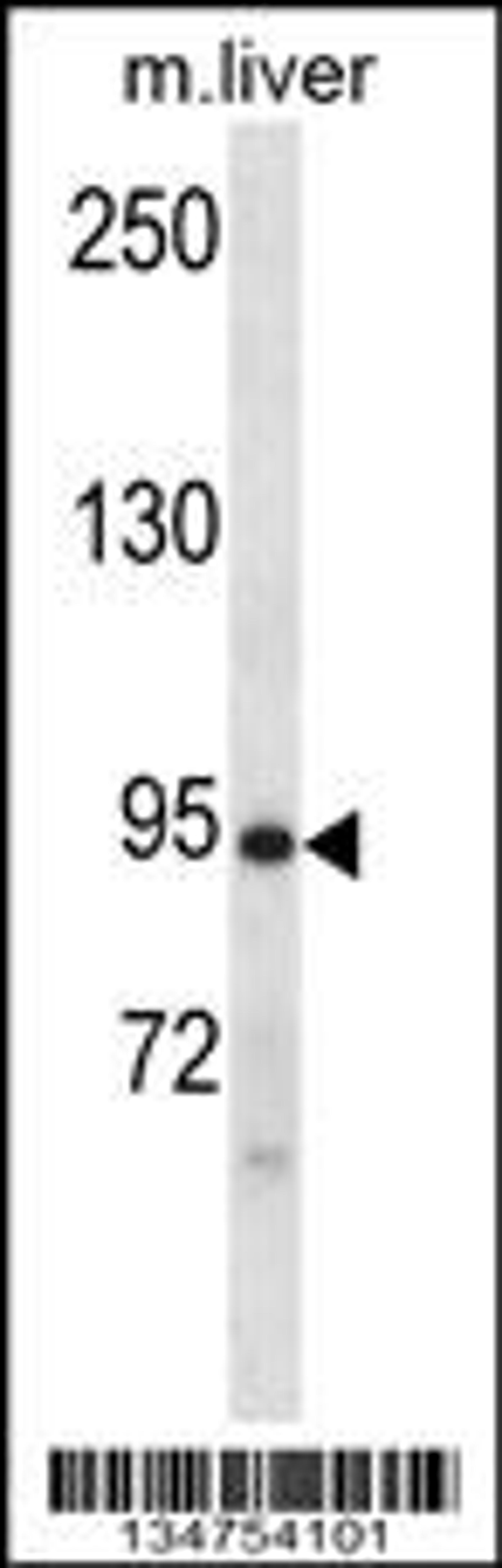 Western blot analysis in mouse liver tissue lysates (35ug/lane).