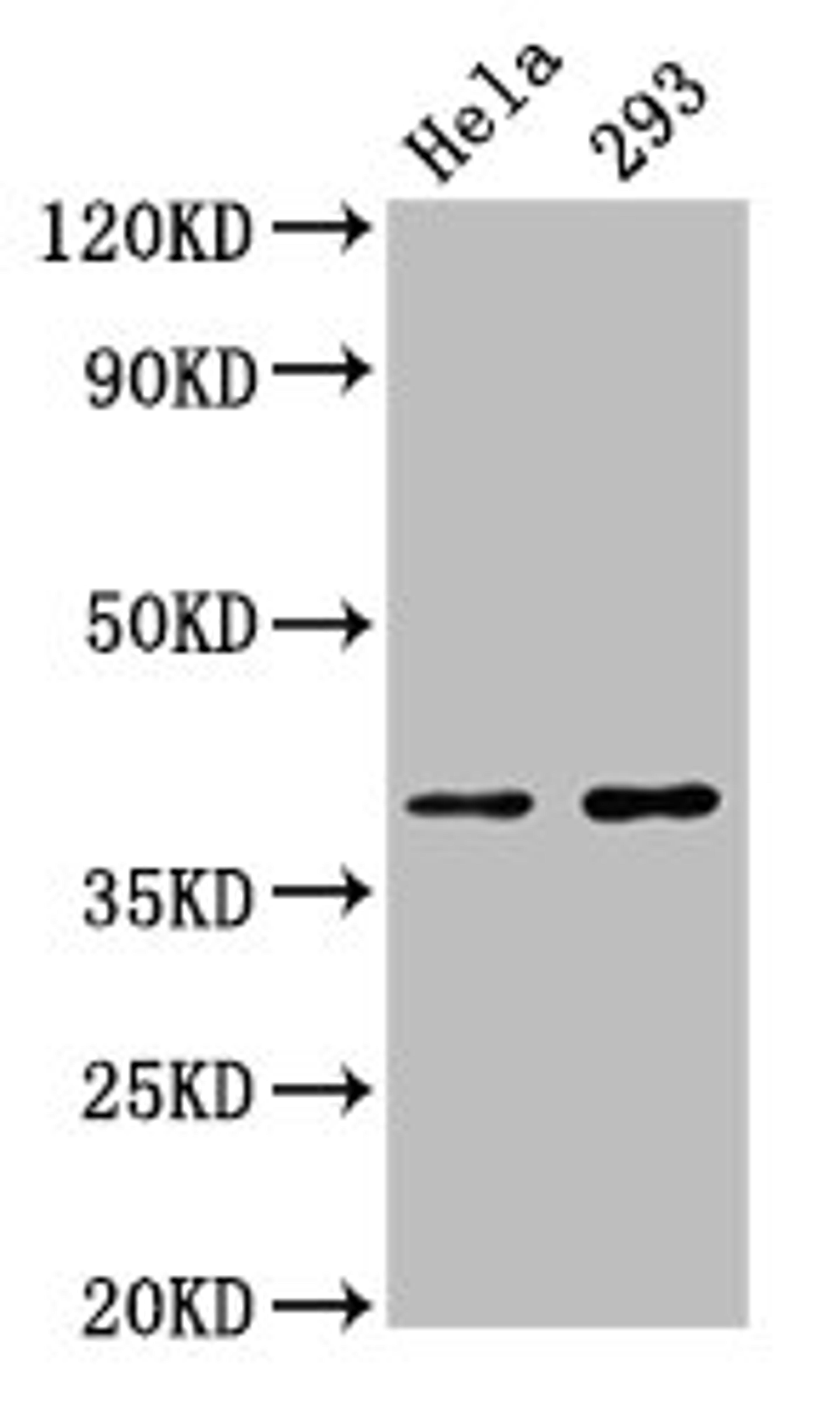Western Blot. Positive WB detected in: Hela whole cell lysate, 293 whole cell lysate. All lanes: FOXH1 antibody at 2.7µg/ml. Secondary. Goat polyclonal to rabbit IgG at 1/50000 dilution. Predicted band size: 40 kDa. Observed band size: 40 kDa