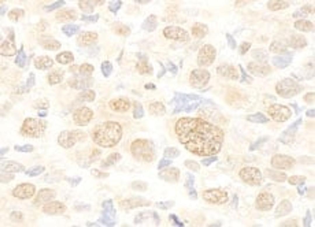 Detection of human FUSIP1 by immunohistochemistry.