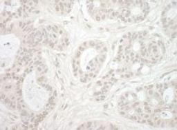 Detection of human Importin 4 by immunohistochemistry.